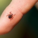 What to Do If You Find a Tick on Your Body